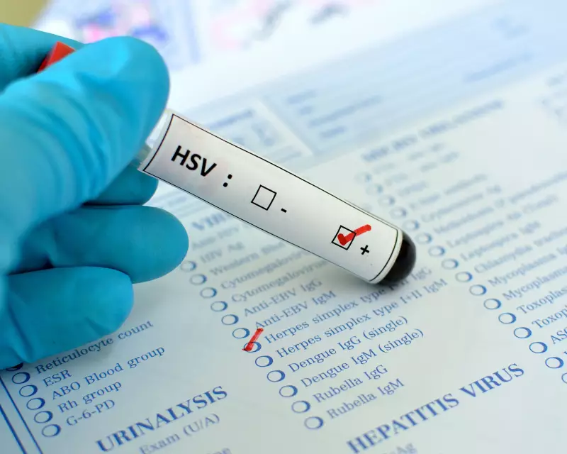 Herpes Genital: Sintomas, Tratamento e Como Prevenir
