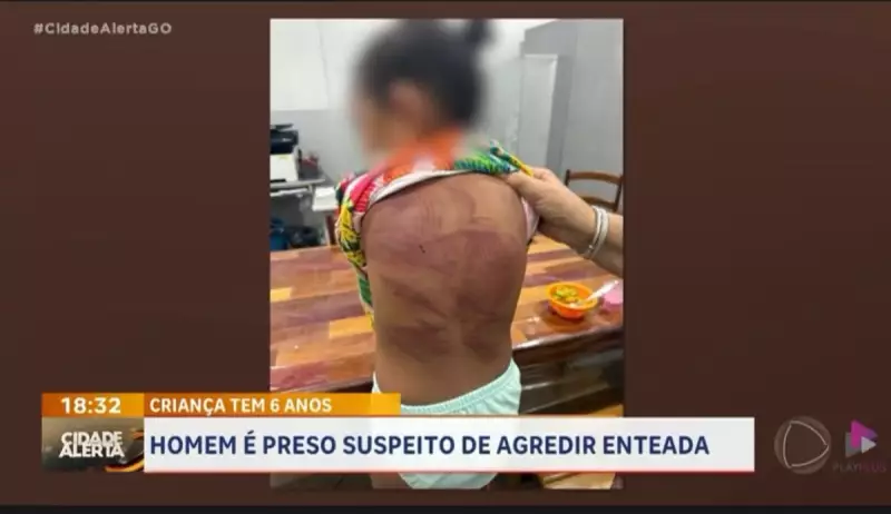 Homem é preso por espancar enteada de 6 anos em Goianira: caso choca cidade