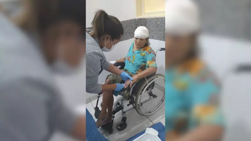 Idosa de 67 anos é atacada por Pitbull em São José do Rio Preto, SP: saiba detalhes