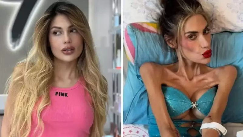 Influencer morre aos 30 anos após batalha contra distúrbio alimentar: uma história de luta e conscientização