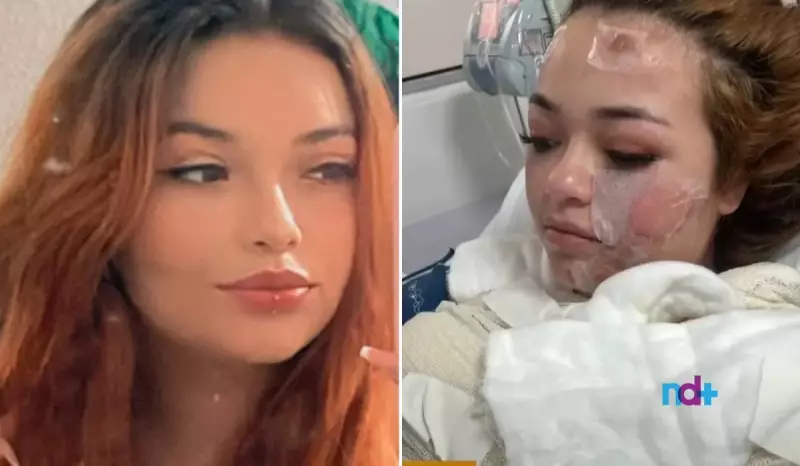 Jovem morre após sofrer queimaduras graves em banheira de motel no Paraná