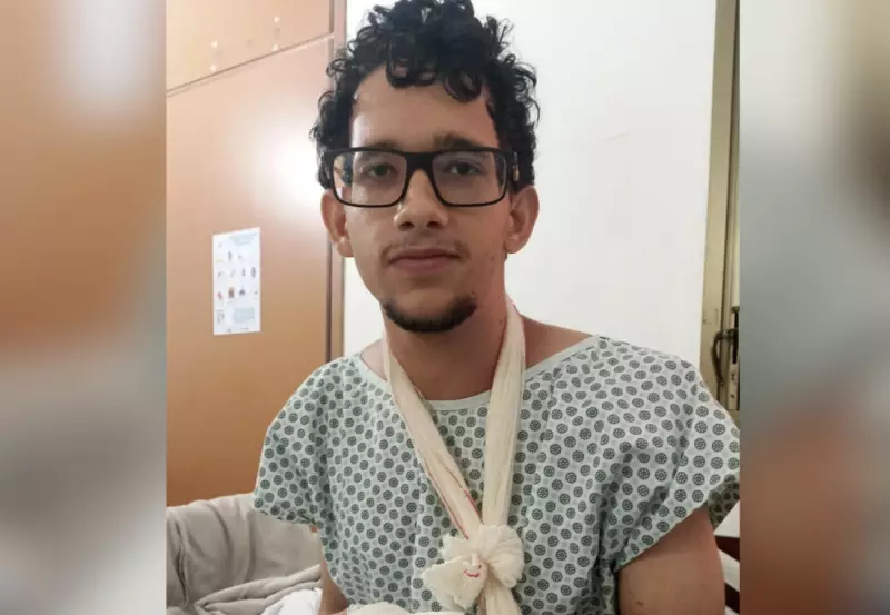 Jovem sofre ferimentos graves após explosão de bolo em festa de aniversário no Tocantins