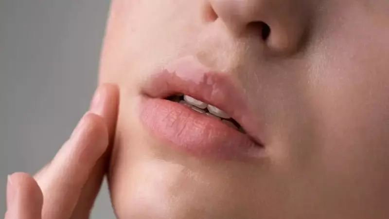 Labios rachados no frio? Descubra dicas infalíveis para proteger e hidratar