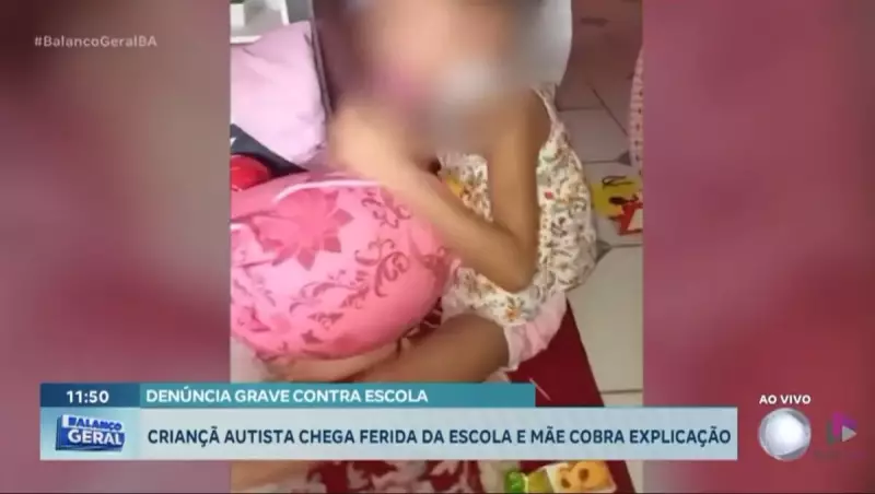 Mãe denuncia escola após filha autista aparecer com marcas de agressão na Bahia