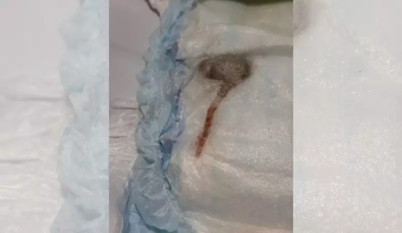 Mãe encontra rato morto em fralda de bebê: caso choca e vai parar na polícia