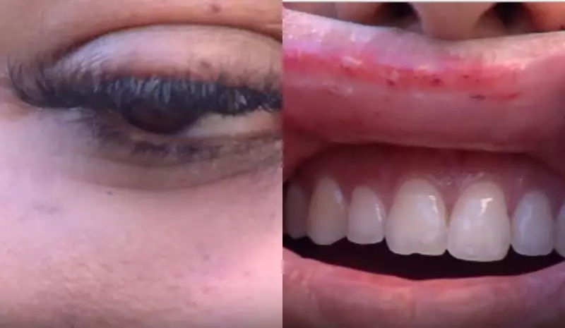 Manicure é brutalmente agredida com enxada por ex após cobrar dívida no ES