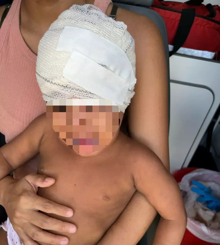 Menina de 2 anos é ferida por pedrada durante briga de vizinhos em Boa Vista