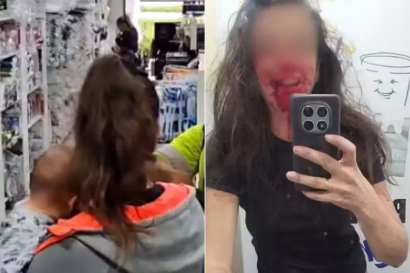 Mulher é agredida por assaltante enquanto amamentava filho em Santos e teme pela família: 'Ele sabe onde me encontrar'