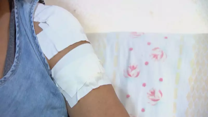 Mulher é baleada durante Festa Junina em BH: 'Senti um impacto enorme no ombro'