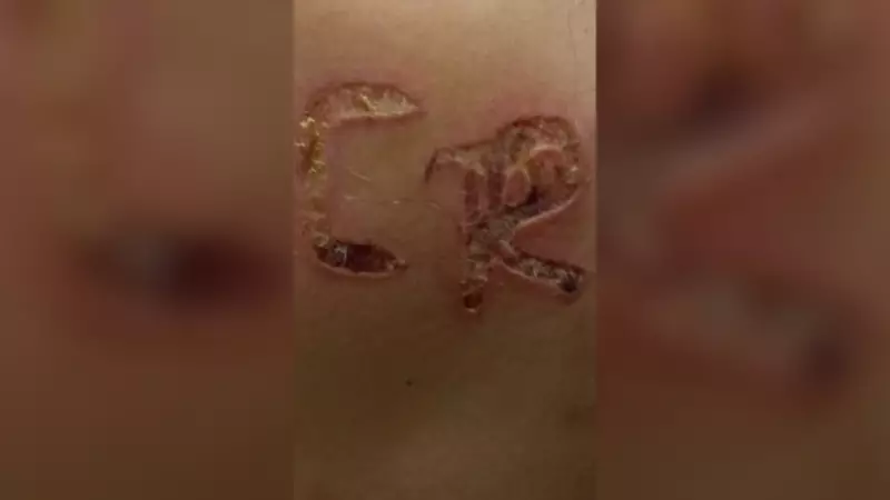 Mulher é torturada e marcada a ferro quente com iniciais do marido em São José do Rio Preto