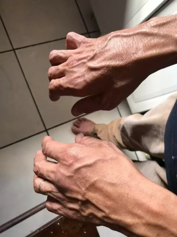Novo tratamento brasileiro para hanseníase promete cura mais rápida e pode chegar ao SUS