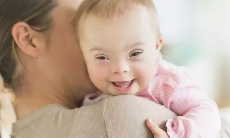 Paraíba aprova lei que obriga hospitais a notificar nascimentos de bebês com síndrome de Down