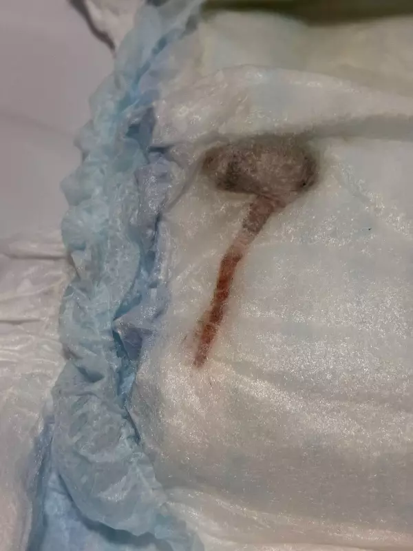 Perícia revela: material em fralda de bebê não era rato — entenda o caso