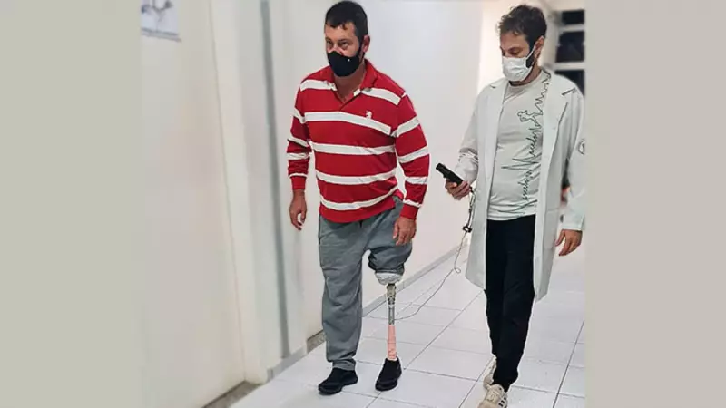 Pesquisadores da Unesp de Bauru criam prótese mais leve e barata: avanço para a saúde pública