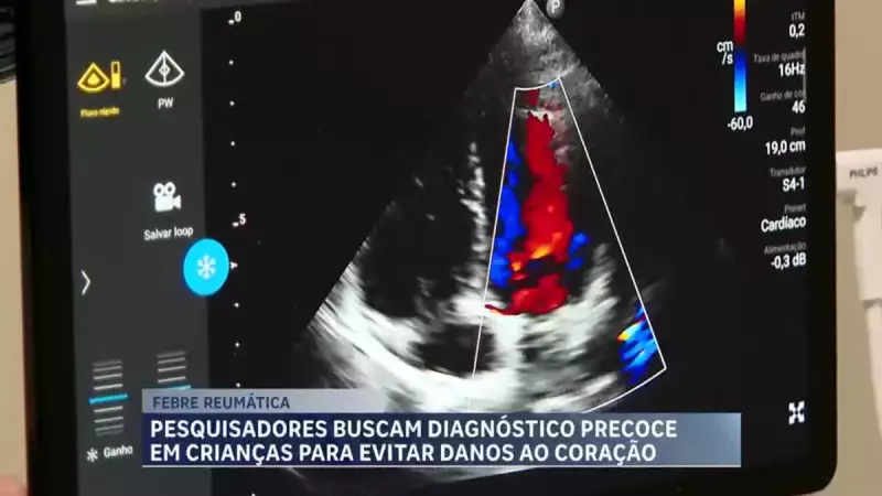Pesquisadores em MG buscam diagnóstico precoce para febre reumática em crianças