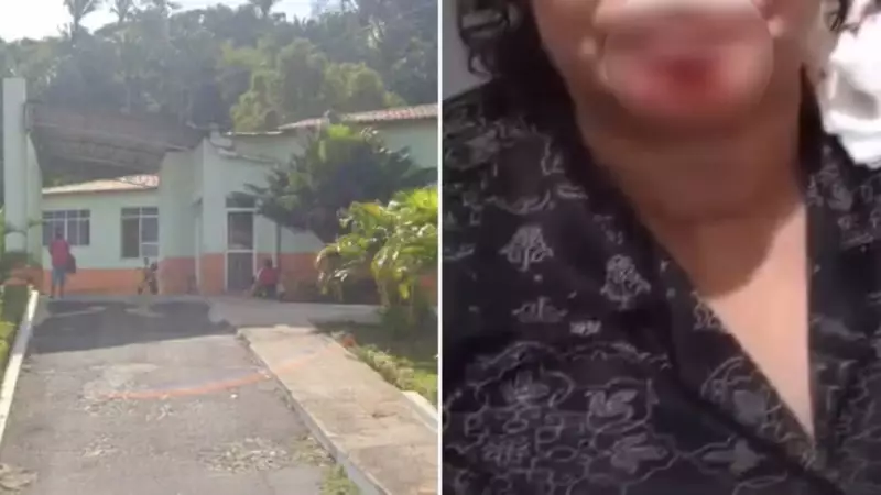 Professor vira réu após arrancar pedaço do queixo da namorada com mordida em briga