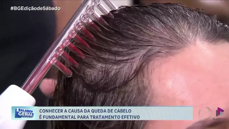 Queda de cabelo: sinais de alerta e tratamentos personalizados para recuperar os fios