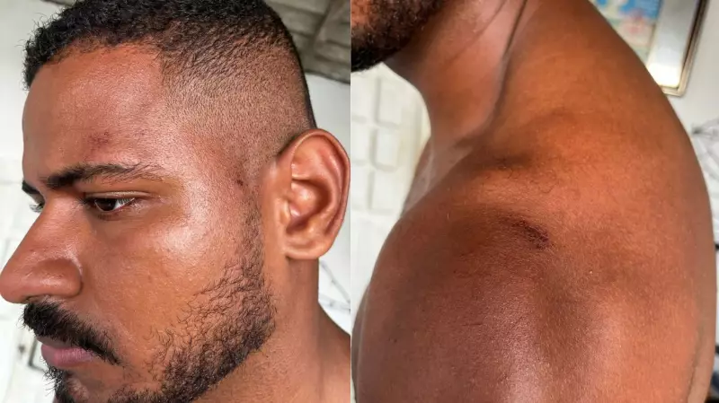 Racismo e violência policial marcam show no São João de Caruaru: analista relata agressões