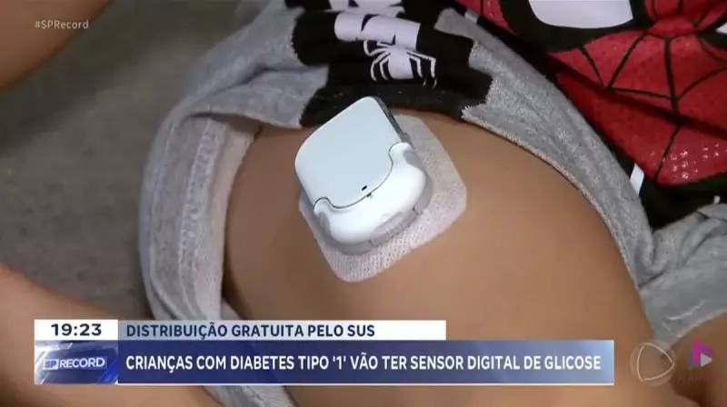 Ribeirão Preto oferece sensores de glicose gratuitos para crianças com diabetes