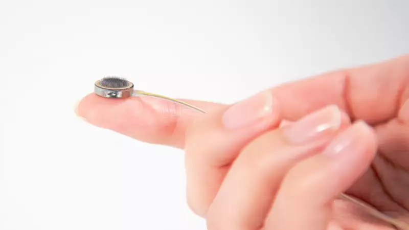 Rival da Neuralink testa primeiro implante cerebral em humano: como funciona a tecnologia revolucionária