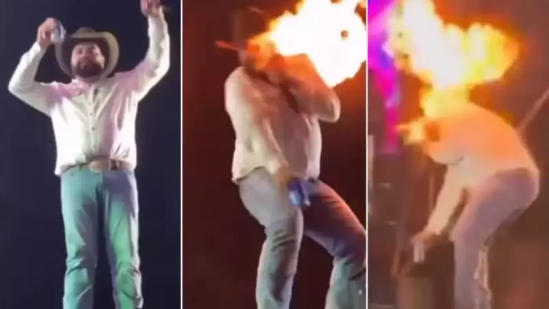Sertanejo revela transformação no rosto após acidente em show: veja o antes e depois