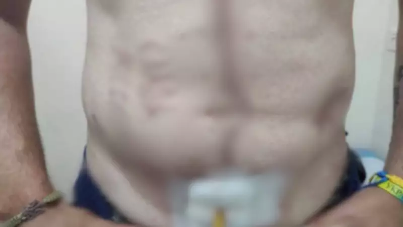 Soldado ucraniano tem 'Glória à Rússia' tatuado durante cativeiro: relato chocante