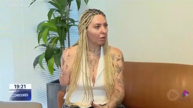 Tatuadora tem braço amputado após complicações em lipoaspiração: entenda o caso