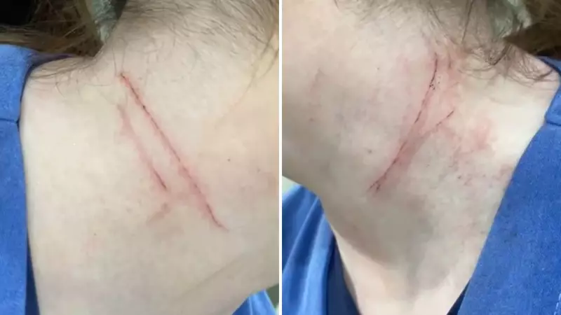 Técnica de enfermagem é agredida e estrangulada dentro de UPA em Jales; assista ao vídeo chocante