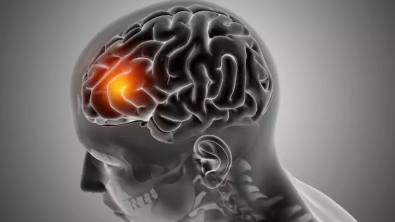 Terapia inovadora reduz tumor cerebral em 62% dos pacientes, revela estudo