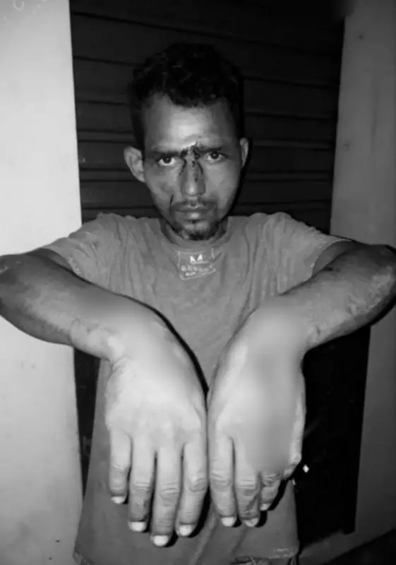 Vítima de violência policial no Acre pede indenização de R$ 300 mil após ser espancado e pregado em assoalho