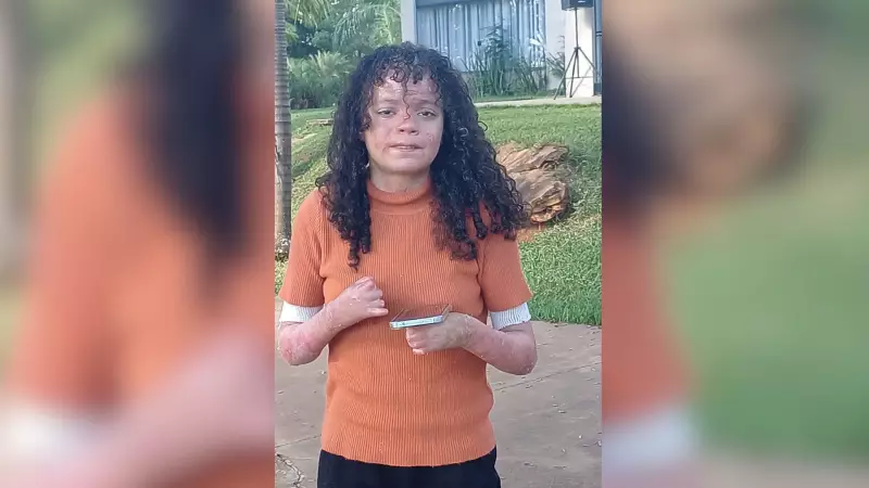 Adolescente com epidermólise bolhosa enfrenta desafios para obter curativos do governo