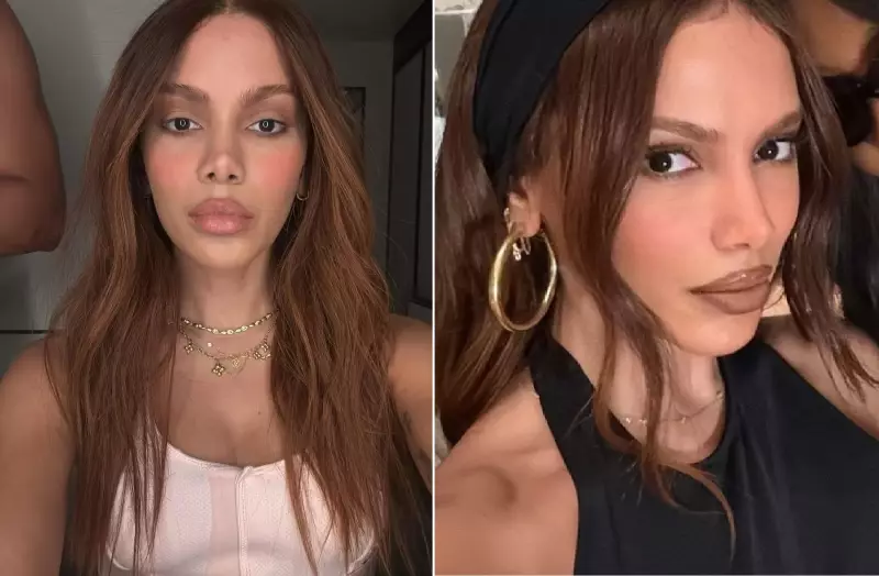 Anitta e os bastidores tensos após cirurgia plástica: comparada a Michael Jackson