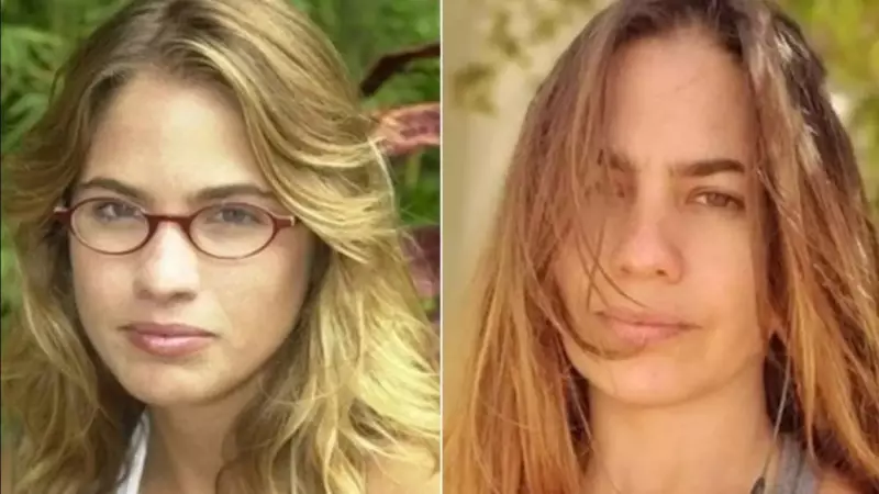 Atriz de 'Malhação' fica cega após agressão e revela abusos chocantes: 'Vivi um inferno'