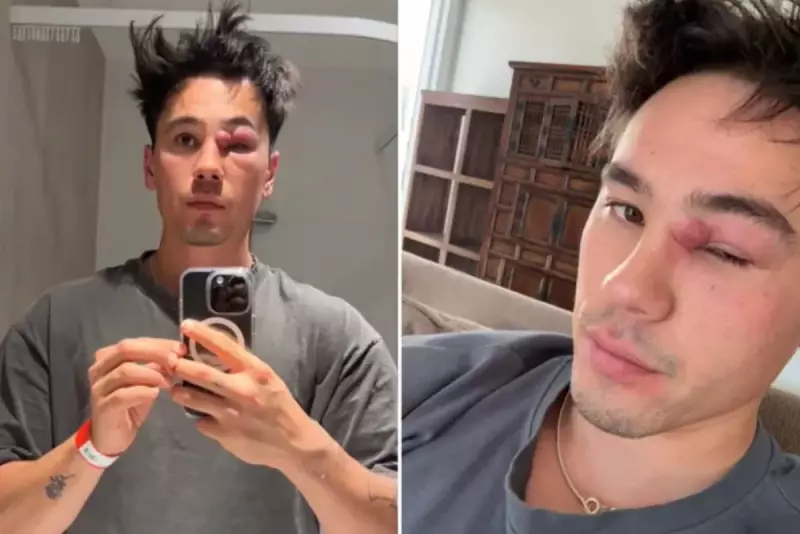 Australiano confunde cisto com espinha e termina com rosto desfigurado — veja o antes e depois