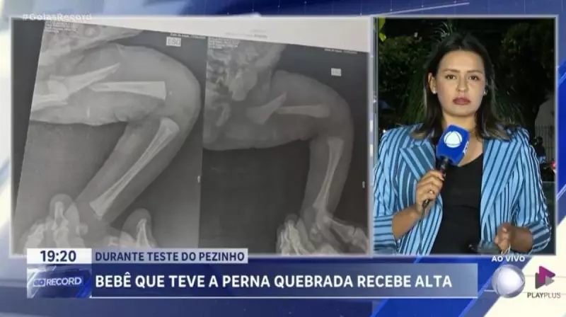 Bebê de Goiás recebe alta após fratura na perna durante Teste do Pezinho: entenda o caso