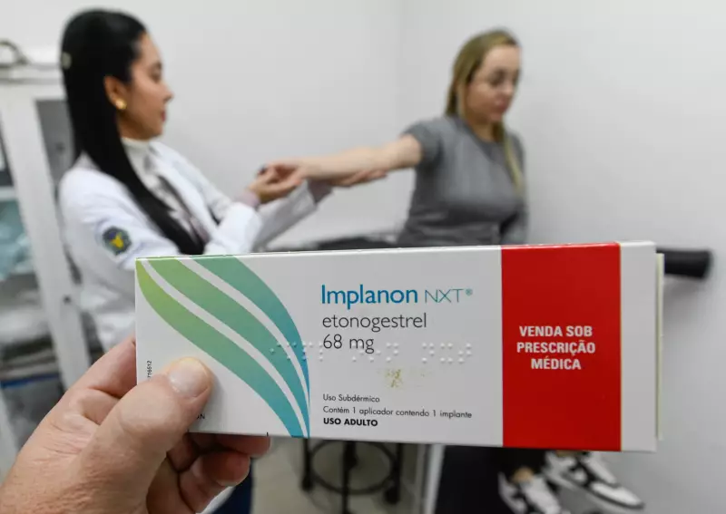 Campinas distribui 28 mil implantes contraceptivos pelo SUS em 4 anos: como funciona?