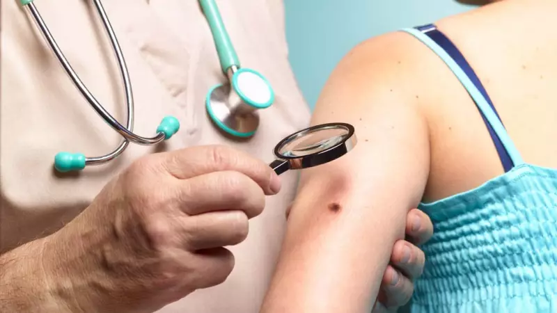 Câncer de Pele em Jovens: O Aumento Alarmante que Ninguém Esperava