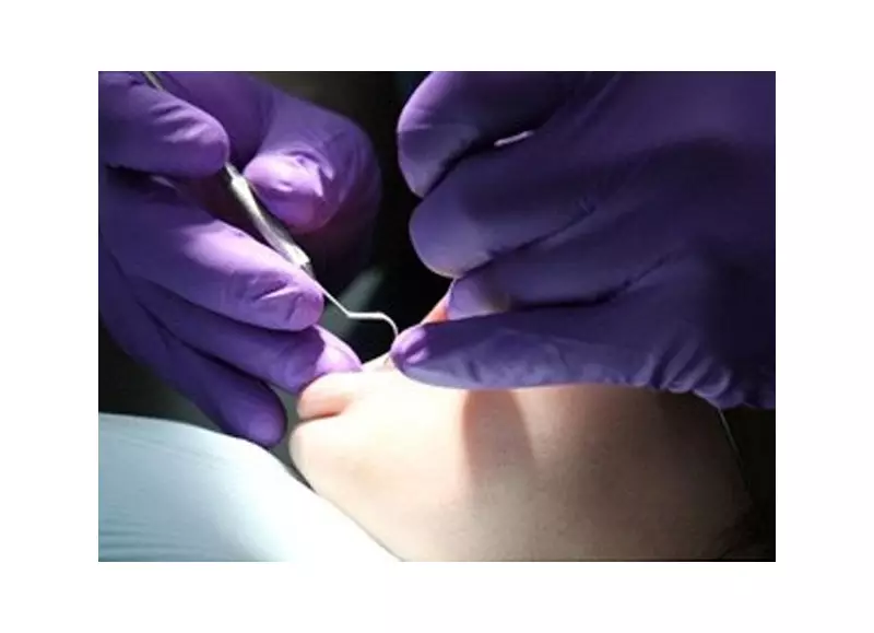 Clínica odontológica é condenada por extrair dente errado de paciente no DF — Saiba os detalhes