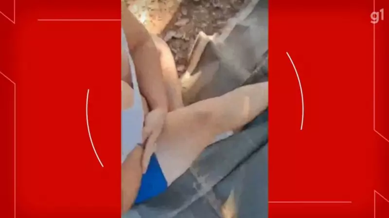 Confusão no Eixão do Lazer termina com mulher ferida e braço quebrado — Veja o vídeo chocante