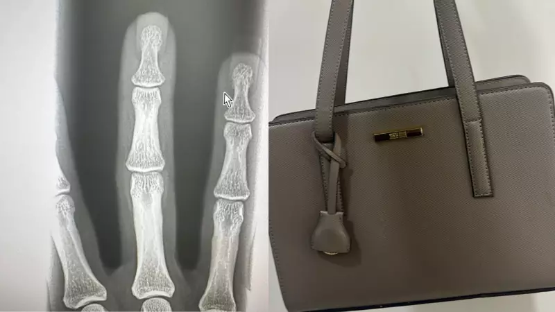 Coragem à prova de balas: Mulher desafia bandido e recupera bolsa com dedo quebrado em MG