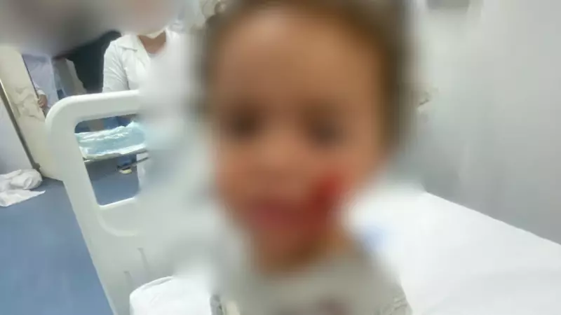 Criança de 1 ano e 7 meses é atacada por pitbull enquanto brincava em calçada no ES