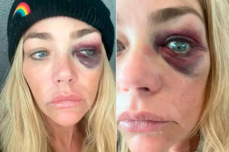 Denise Richards acusa ex-marido de agressão: revelações chocantes do caso