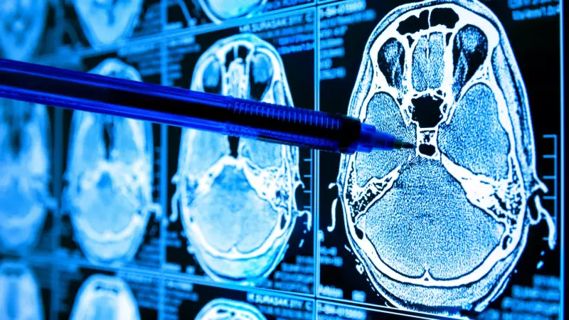 Descoberta revolucionária sobre glicose no cérebro pode ajudar no combate ao Alzheimer
