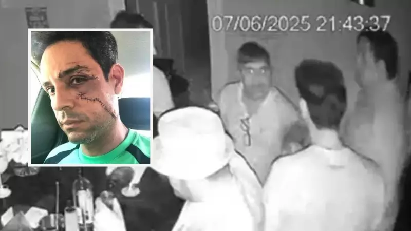 Empresário atacado com copo de vidro no rosto relata: 'Só queria sobreviver'