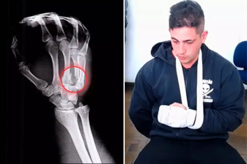 Fisiculturista preso após agredir médica namorada em SP: raio-X revela fratura na mão