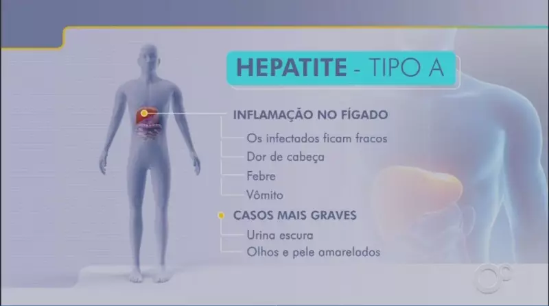 Hepatite A dispara no Brasil: casos aumentam 545% em 2024, alerta Ministério da Saúde
