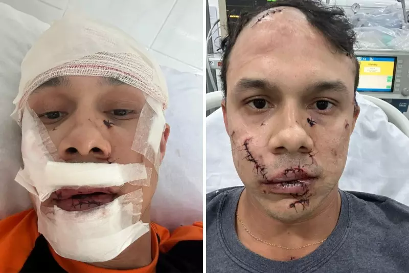 Homem agride garçom com copo de vidro em bar do DF e vítima leva 45 pontos no rosto