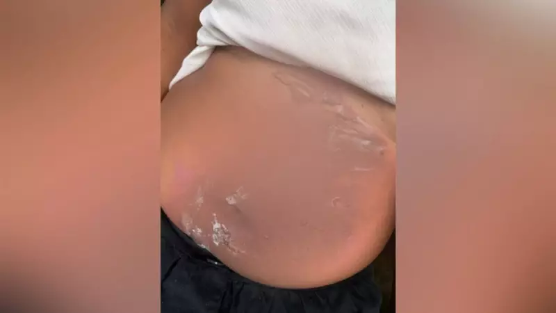 Homem suspeito de jogar água quente em companheira é liberado após depoimento na DEAM de Santarém