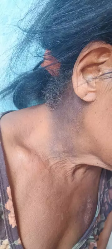 Idosa desaparecida é encontrada agredida e confusa em mata no Norte de Minas