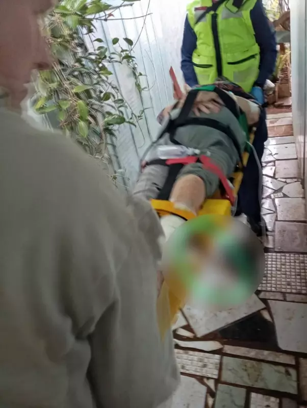 Idosa sofre acidente grave em SC: perna perfurada por barra de ferro após queda